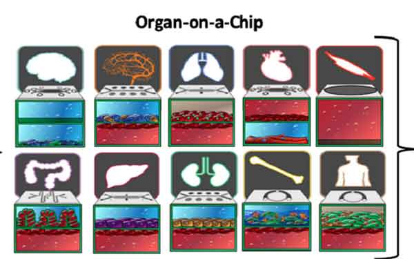 organ on a chip